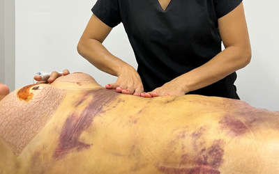 Cuidado post operatorio